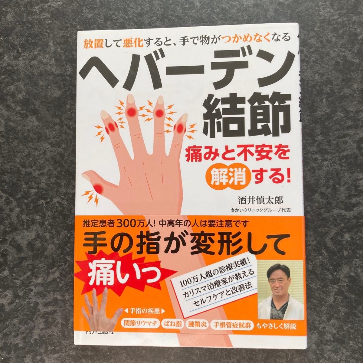 赫伯登结节：消除疼痛与不安！酒井慎太郎