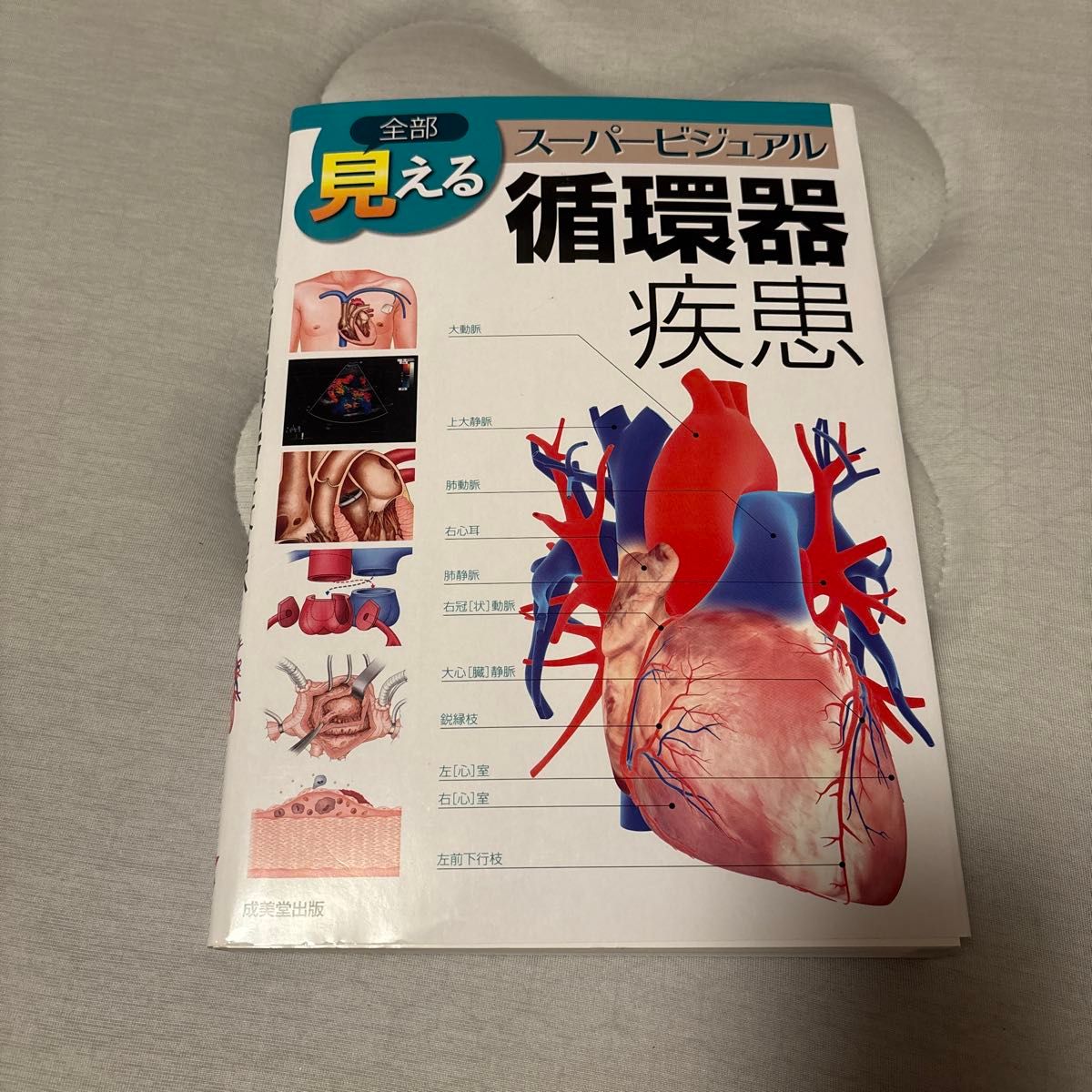 全部見える スーパービジュアル 循環器疾患 成美堂出版